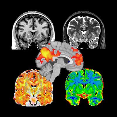 Neuroimaging Methods McGill Centre For Integrative Neuroscience